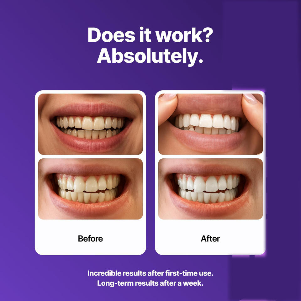 Violet Color Correcting Whitening Strips